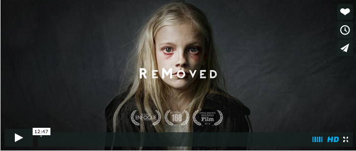 You are currently viewing Worth Watching #151: ReMoved